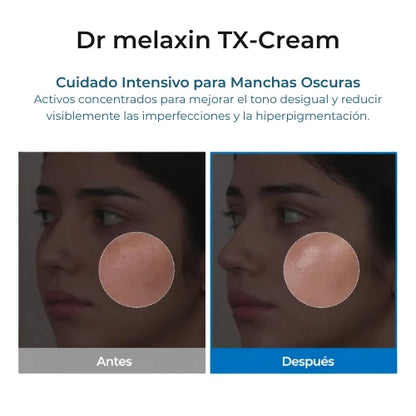 Dr.Melaxin TX-Crema 30ml | Concentrado Corrector de Grado Dermatológico